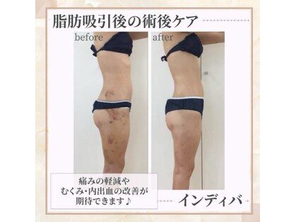 カノン(Kanon.)の写真