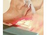 【朝のヒゲ剃りから解消され清潔感あるお肌に】　メンズヒゲ脱毛30分