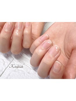 爪の悩みを解消できる（ケア含む）