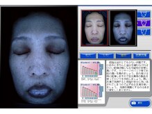 ベティ アンド ボーテの雰囲気（肌診断機の画像です。）