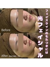 カヨン 新所沢店(KAYON)/フェイスラインスッキリ♪小顔へ