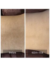 アネル 宮古島店(anel)/