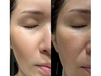 ミレマユメイク(mire)/印象が変わるアイブロウ施術