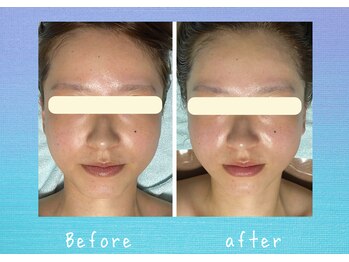 マタハリ(Matahari)/小顔コルギ