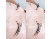 エネル バイ アルト(eneru by arto)/バインドロック150束