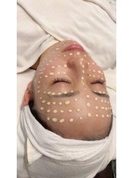 エステサロン ロティオンの写真/まるでファンデーションを纏っているような艶肌に大満足