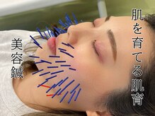 モンダロ(MONDARO)の雰囲気（たるみ、ほうれい線でお悩みの方には美容鍼がオススメ！）