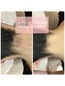 【女性】首スッキリ♪うなじ脱毛
