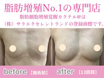 サラエクセレント 新宿(SARA EXCELLENT)/確実なバストアップ！