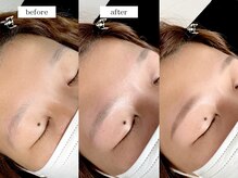 エムドット(m.)/アイブロウワックス脱毛