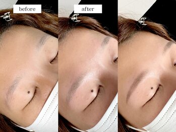 エムドット(m.)/アイブロウワックス脱毛