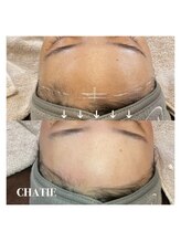 チャティー(CHATIE)/美白フェイスワックス