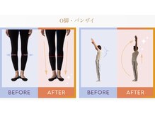 デップ 高松店(DEP)の雰囲気（脚のお悩み、肩周りのお悩みもあなたに合わせた方法で徹底改善！）