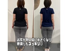 ナナ 札幌店(NANA)/30代会員様のビフォーアフター