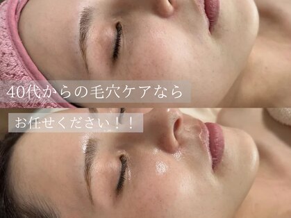 アネラ(ANERA)の写真