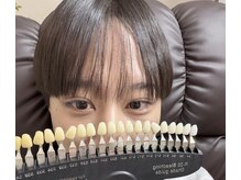 ナチュラ(Natura)/年齢問わず人気なホワイトニング