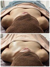 ルミエール(Lumiere)/【倉敷市】バストアップ施術事例