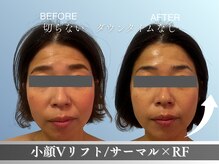 リヴィア(LIVIA)の雰囲気（たるみ・シワにお悩みの方に。福山初リアボーテKIWAMI導入店！）