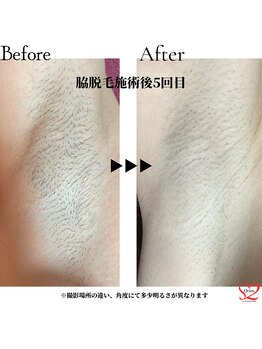 オリオンドットエスツー(Orion.S2)/【Before→After】