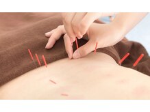 うめだ鍼灸整骨院/