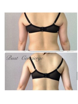 カレン(KAREN)/背中美!見た目ほっそり背中ケア