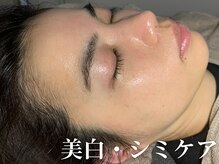 キー(kii)/若い方でもエイジングケア
