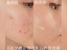 ハイフン(HIFUN)/クリスティーナ生理前/食生活