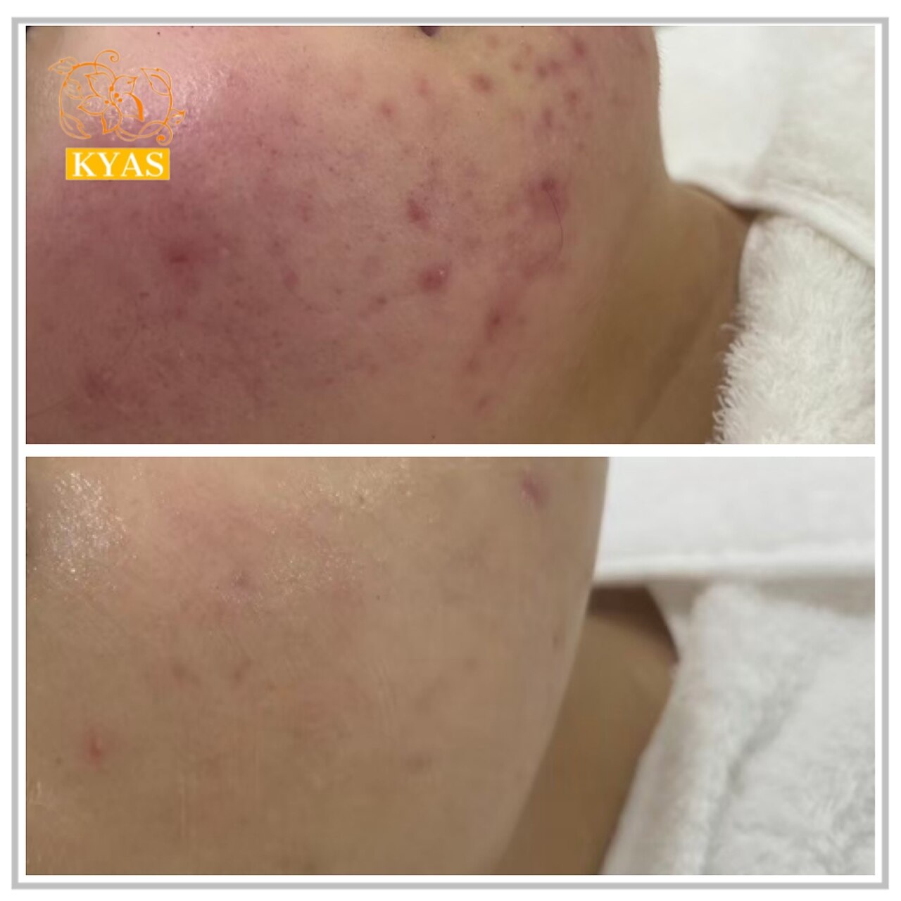 キャス(KYAS)｜ホットペッパービューティー