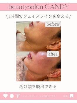 ビューティーサロン キャンディ 海老名(Candy)/