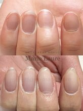 マリーロール 梅田店(Marie Laure)/深爪改善/自爪育成/ネイルケア