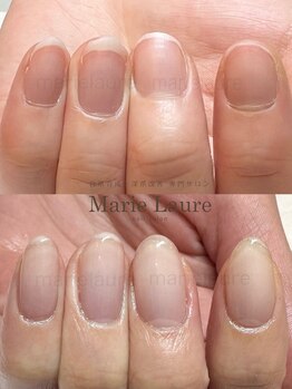 マリーロール 梅田店(Marie Laure)/深爪改善/自爪育成/ネイルケア