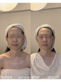 フロル(FLOR)/FLOR【根本改善専門店】