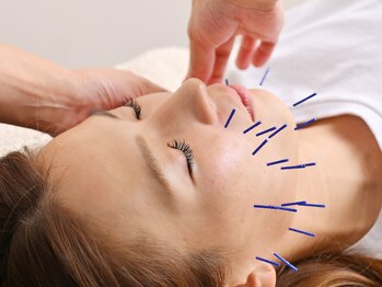 あすか鍼灸整骨院 アスカボディファクトリー(ASUKABodyFactory)/美容鍼で輝く肌