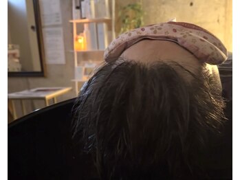 ソルナ 高槻(Soluna)の写真/夜中に何度も目が覚める…朝スッキリ起きられない…休んでも疲れが残る…そんな方必見!