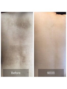 アネル 宮古島店(anel)/