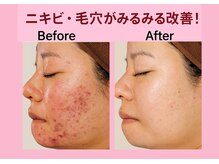 おうちサロン ミキ