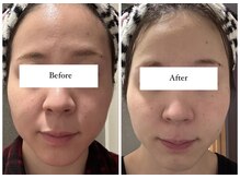 ジョーヌ(JAUNE)/ホームケアでも肌質改善