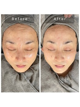 サロン ルイス アディクト(salon Lewis Addict)/【次世代サーマル】HIRF WAVE