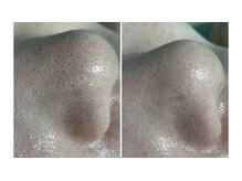 素肌キレイラボ(素肌キレイLab.)の雰囲気(ハーブピーリングや毛穴洗浄をサブスクなら最安8,800円で!)