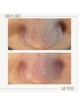 アンド(&.)/before/after