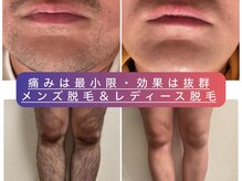 リーベ(Liebe×RNJ)の雰囲気（結果重視！賢く始める、大人の脱毛◎未来の自分へ身だしなみ投資）