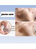 7.8.月限定＜黒ずみ毛穴/リフトアップ ＞毛穴吸引＋ビタミンC＋リフトマスク