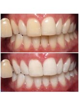 ビューティールームウィズ(beauty room w/)/