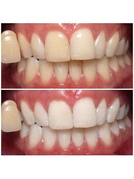 ビューティールームウィズ(beauty room w/)/