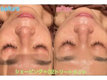 レディースシェービング&ブライダル YOSHIZAWA Inc. BANDAI【2月上旬 OPEN(予定)】の雰囲気(シェービング+O2でお肌の奥に美容液を届け若々しいもちもち肌に)