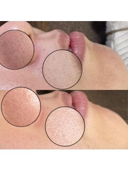 シェリー トウキョウ 西葛西店(Cherie Tokyo)/肌に低刺激なワックス脱毛◎