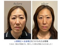 小顔×肌質ケア&経絡ヒーリングKimusubi /年齢によるたるみも変わる！