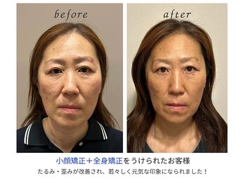 小顔×肌質ケア&経絡ヒーリングKimusubi /年齢によるたるみも変わる!