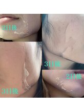 サロン バイオビオ(SALON BioBio)/