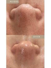 メイクス(Makes)/毛穴洗浄＋フェイシャルワックス